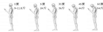 低头看手机，脖子负重50斤